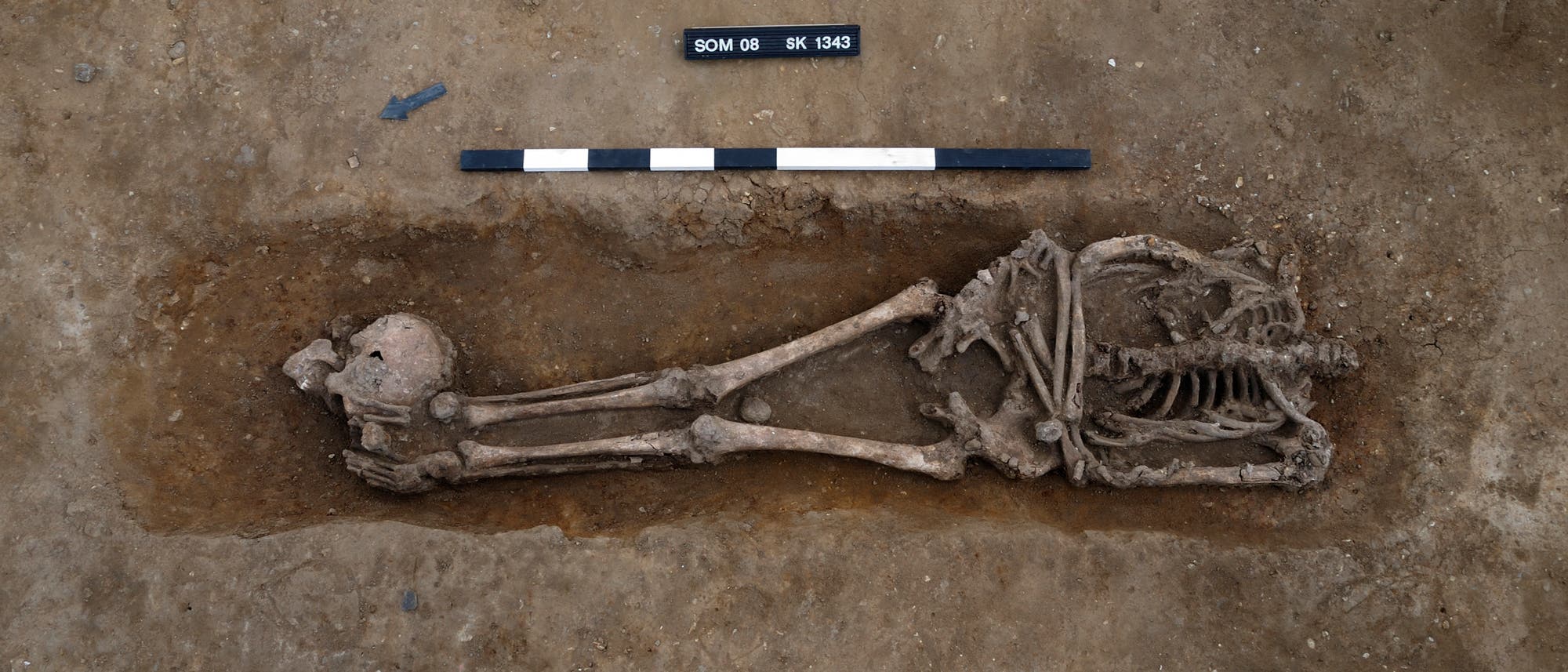 Römerzeitliches Skelett eines Geköpften aus Knobb's Farm, England.