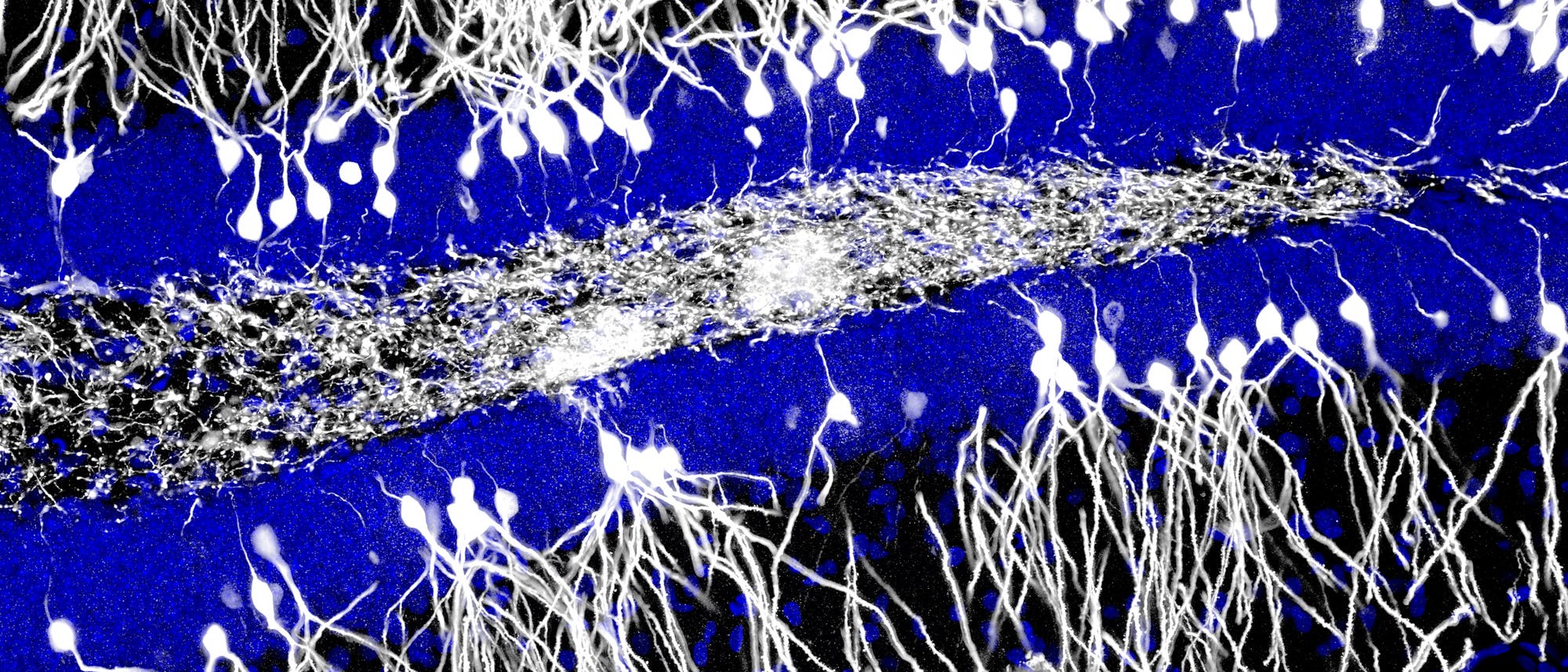 Neurone im Hippocampus