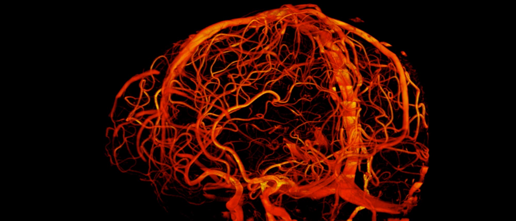 Blutgefäße im Gehirn (Sieben-Tesla-Tomograf)