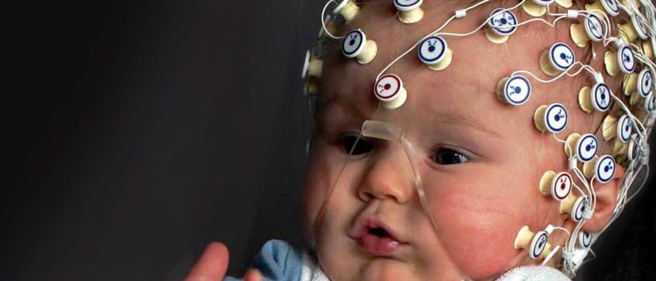 Säugling beim EEG-Versuch