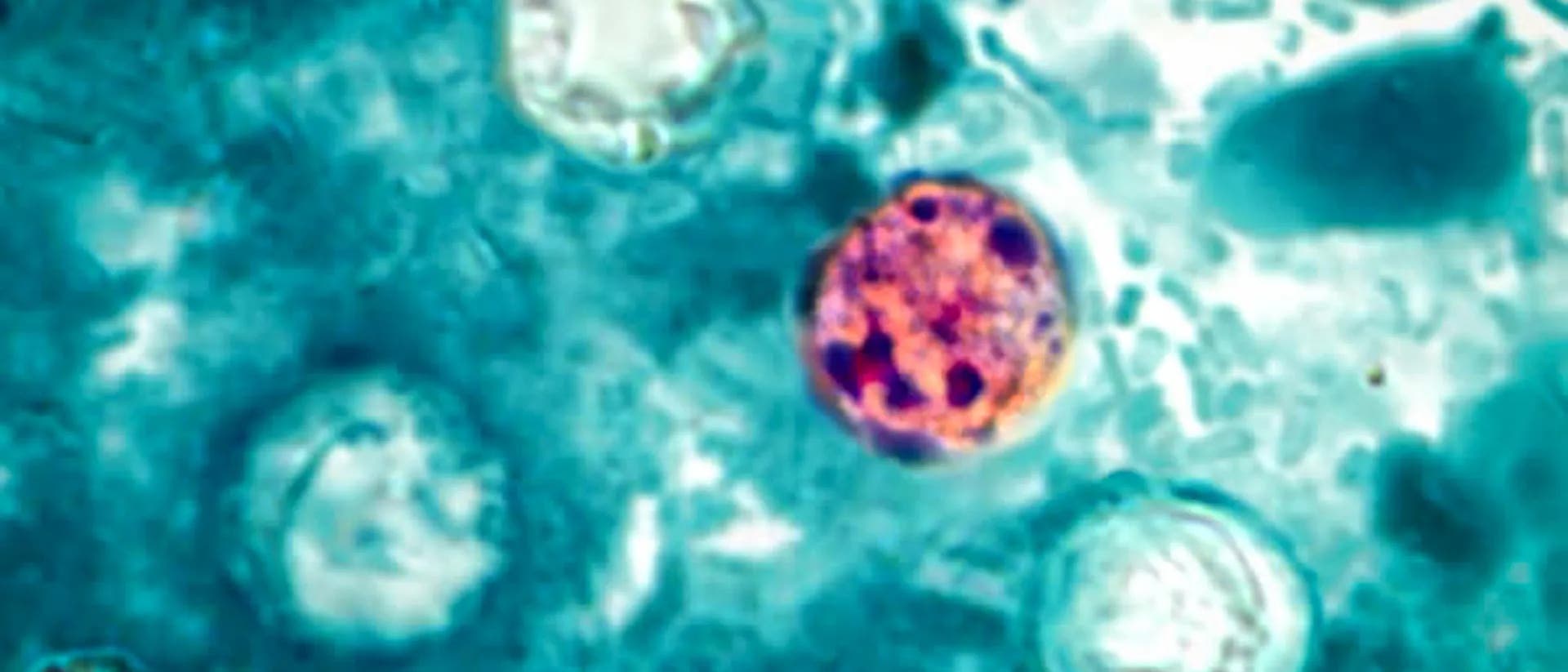 Fluoreszenzmikroskopisches Bild von Zellen, das eine kontrastreiche Darstellung zeigt. Eine Zelle in der Mitte ist in leuchtendem Rot hervorgehoben, umgeben von mehreren bläulich-grünen Strukturen. Die Aufnahme hebt die Unterschiede in der Zellstruktur und -färbung hervor, was auf spezifische biologische oder chemische Prozesse hinweisen könnte. Fluoreszenzmikroskopisches Bild von Zellen, das eine kontrastreiche Darstellung zeigt. Eine Zelle in der Mitte ist in leuchtendem Rot hervorgehoben, umgeben von mehreren bläulich-grünen Strukturen. Die Aufnahme hebt die Unterschiede in der Zellstruktur und -färbung hervor, was auf spezifische biologische oder chemische Prozesse hinweisen könnte.