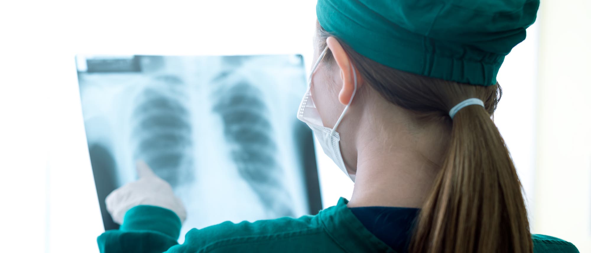Ärztin begutachtet Röntgenbild einer menschlichen Lunge