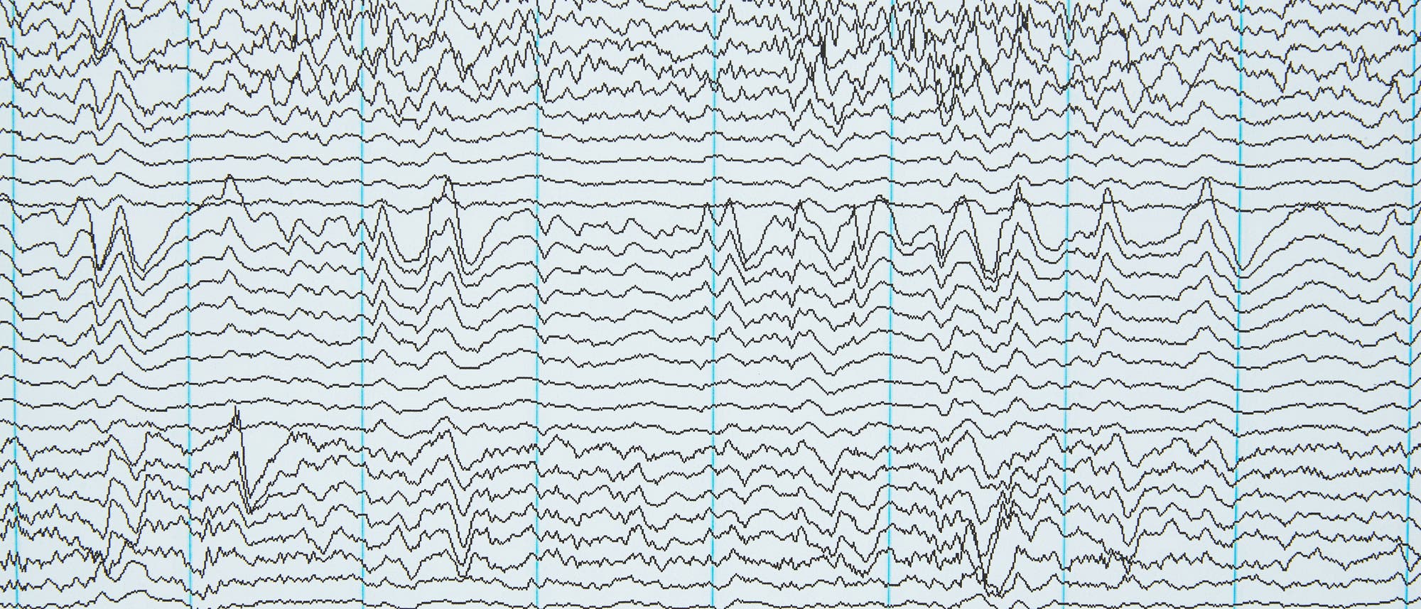 EEG-Wellen auf Papier