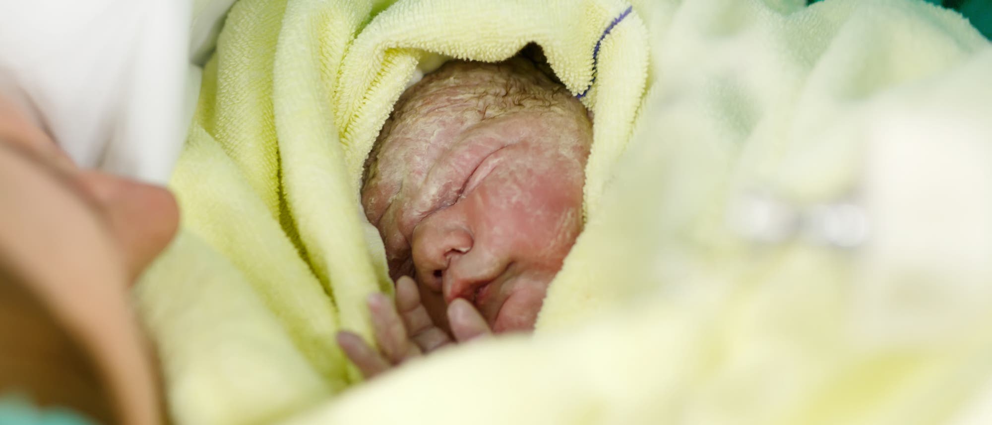 Kühlen hilft nicht allen Neugeborenen mit Sauerstoffmangel - Spektrum der  Wissenschaft