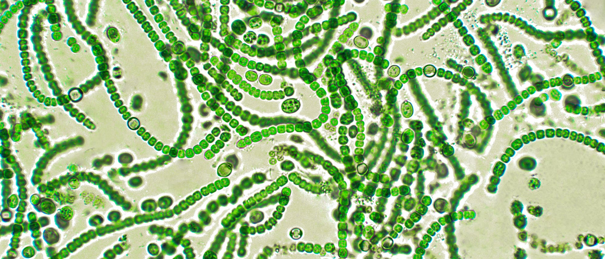 Zyanobakterien