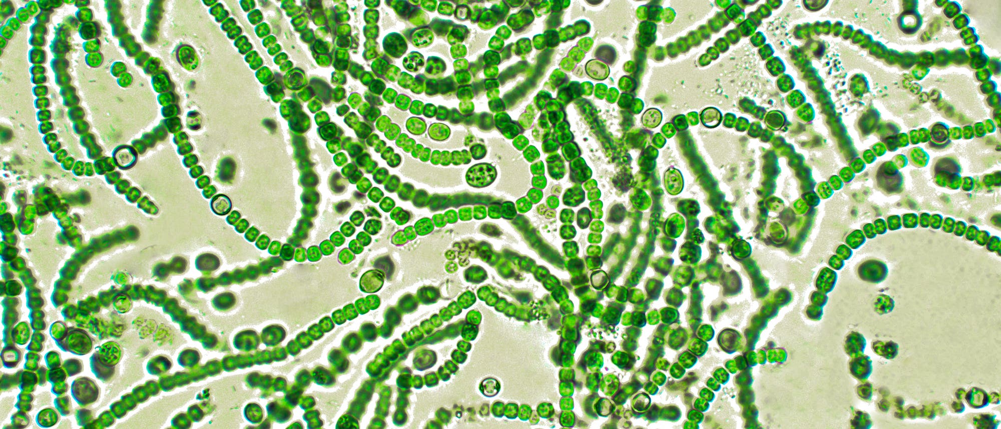 Zyanobakterien, umgangssprachlich auch Blaualgen genannt, kommen an Land und in Süß- wie Salzwasser vor