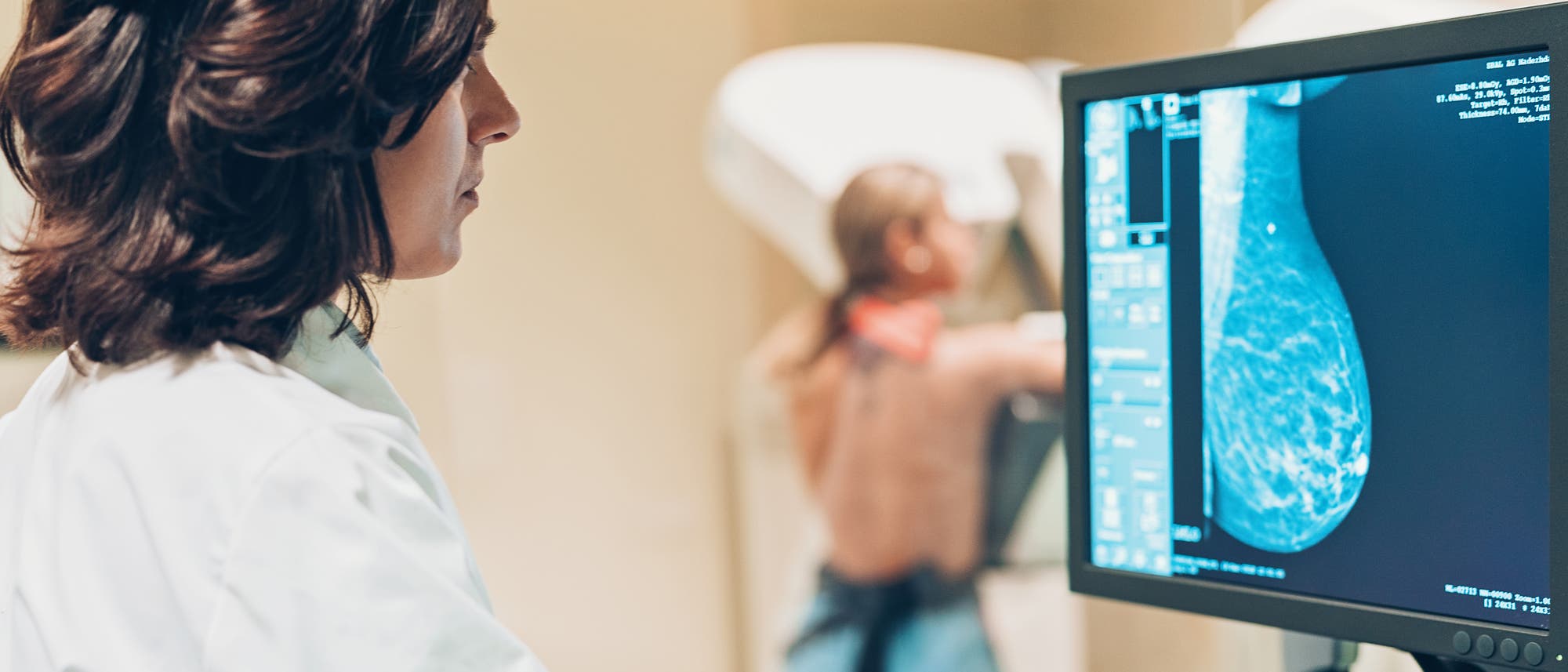 Seit einigen Jahren gibt es in Deutschland ein gesetzliches Früherkennungsprogramm, das Mammografie-Screening für Frauen zwischen 50 und 69 Jahren.