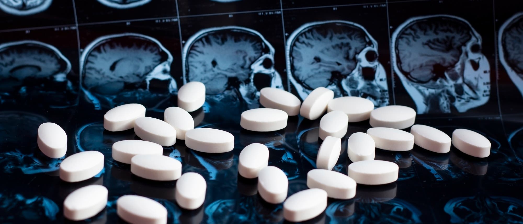 Pillen liegen vor MRT-Aufnahmen eines Gehirns