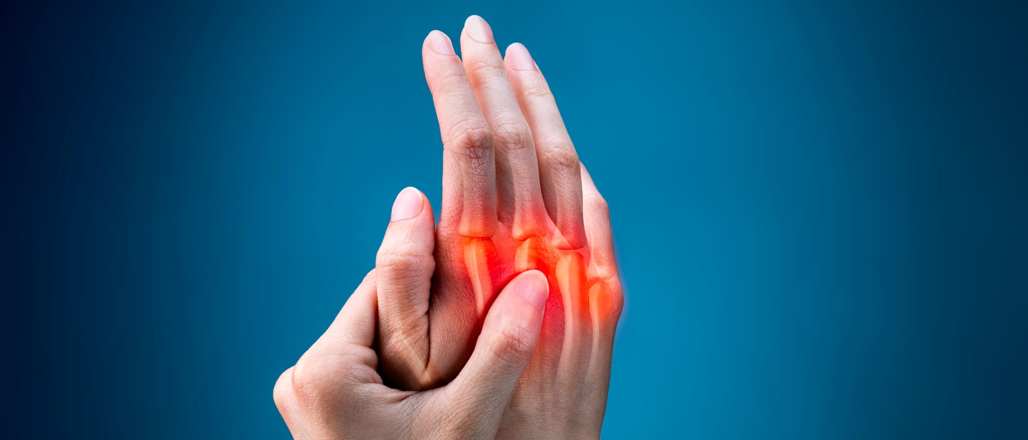 Rheumatoide Arthritis fängt oft in den Finger- oder Zehengelenken an