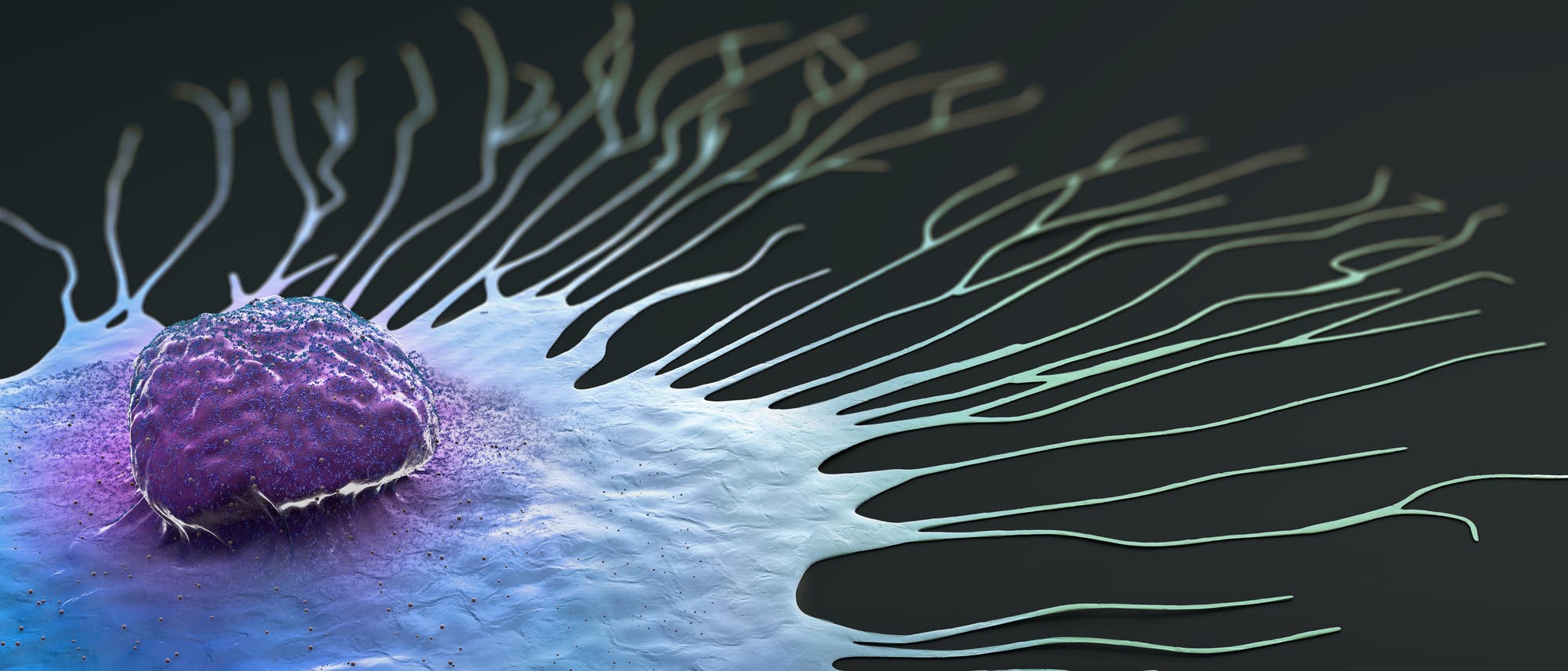 Illustration einer wandernden Brustkrebszelle