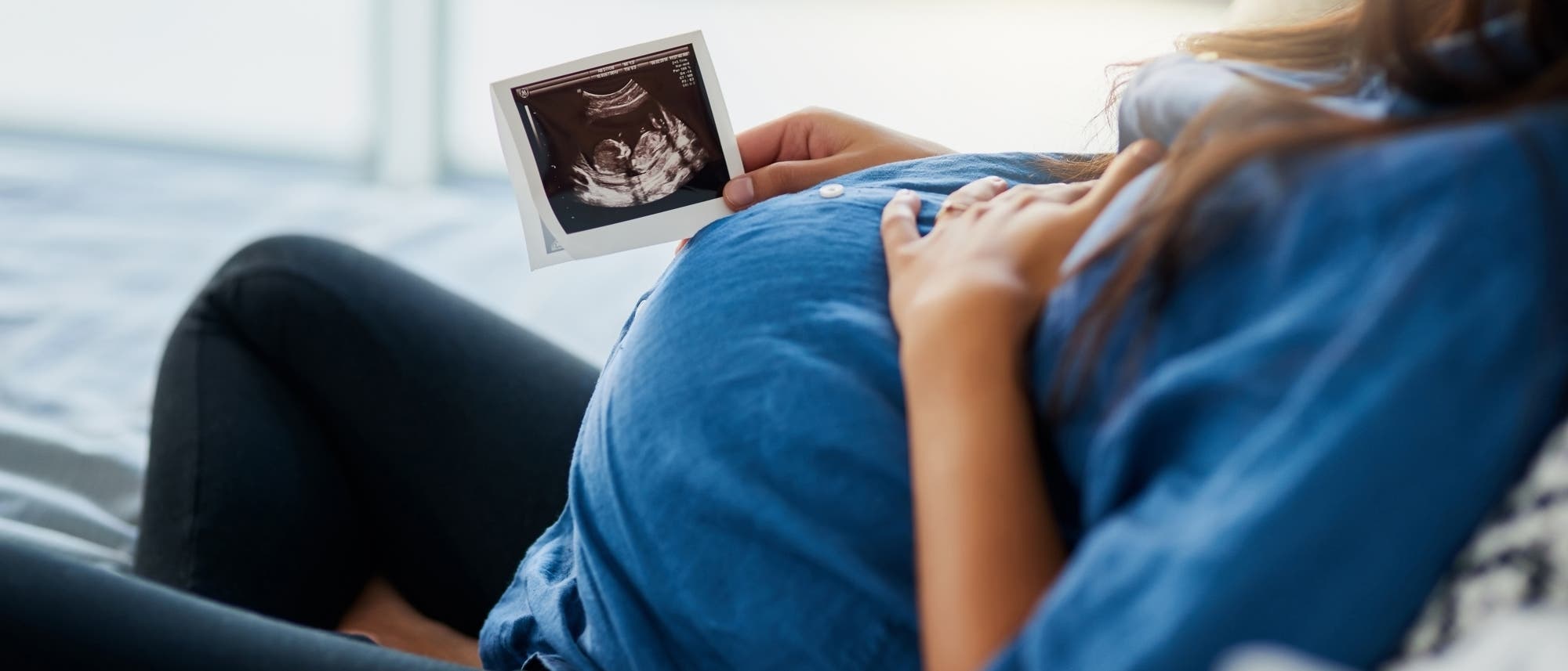 Eine Schwangere hält ein Ultraschallbild eines Ungeborenen in der Hand.