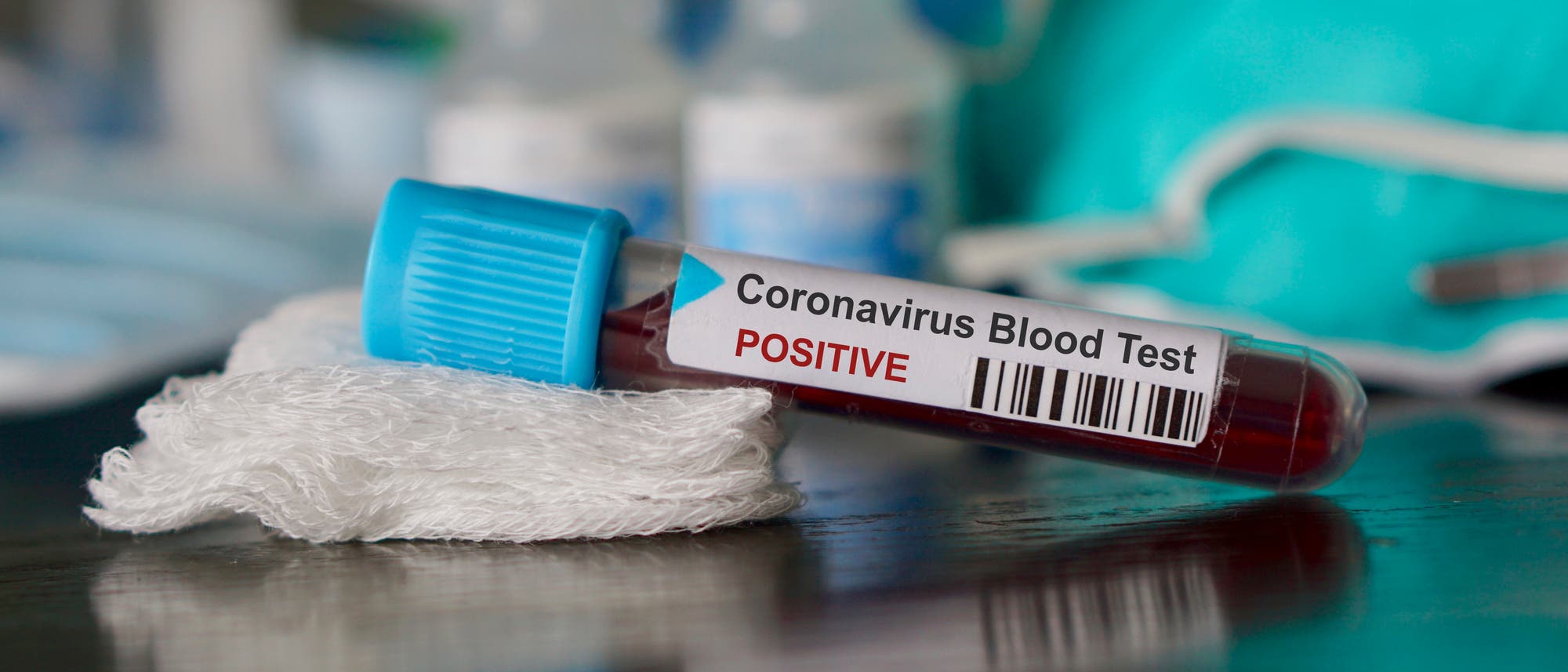 Weltweit stecken sich mehr und mehr Menschen mit dem neuen chinesischen Coronavirus an.
