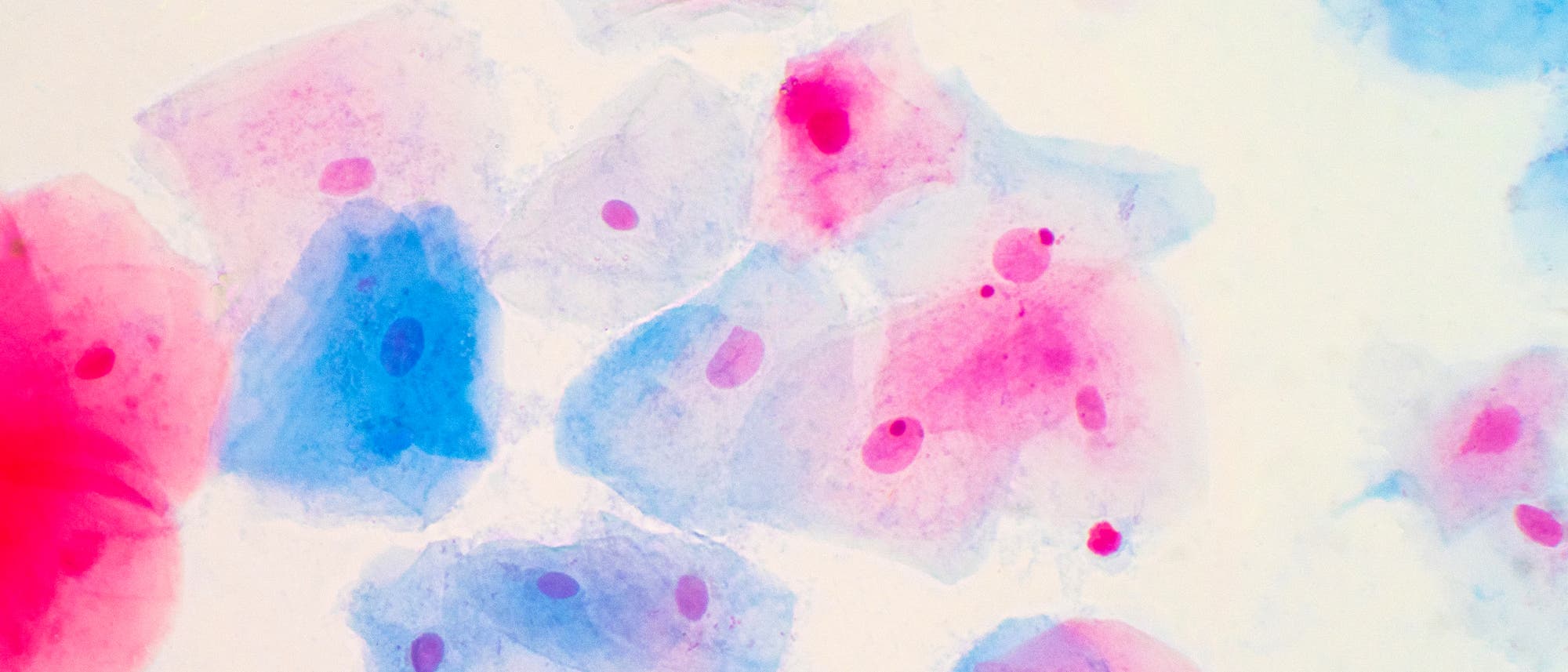 Plattenepithelzellen des Gebärmutterhalses unter Mikroskopansicht.