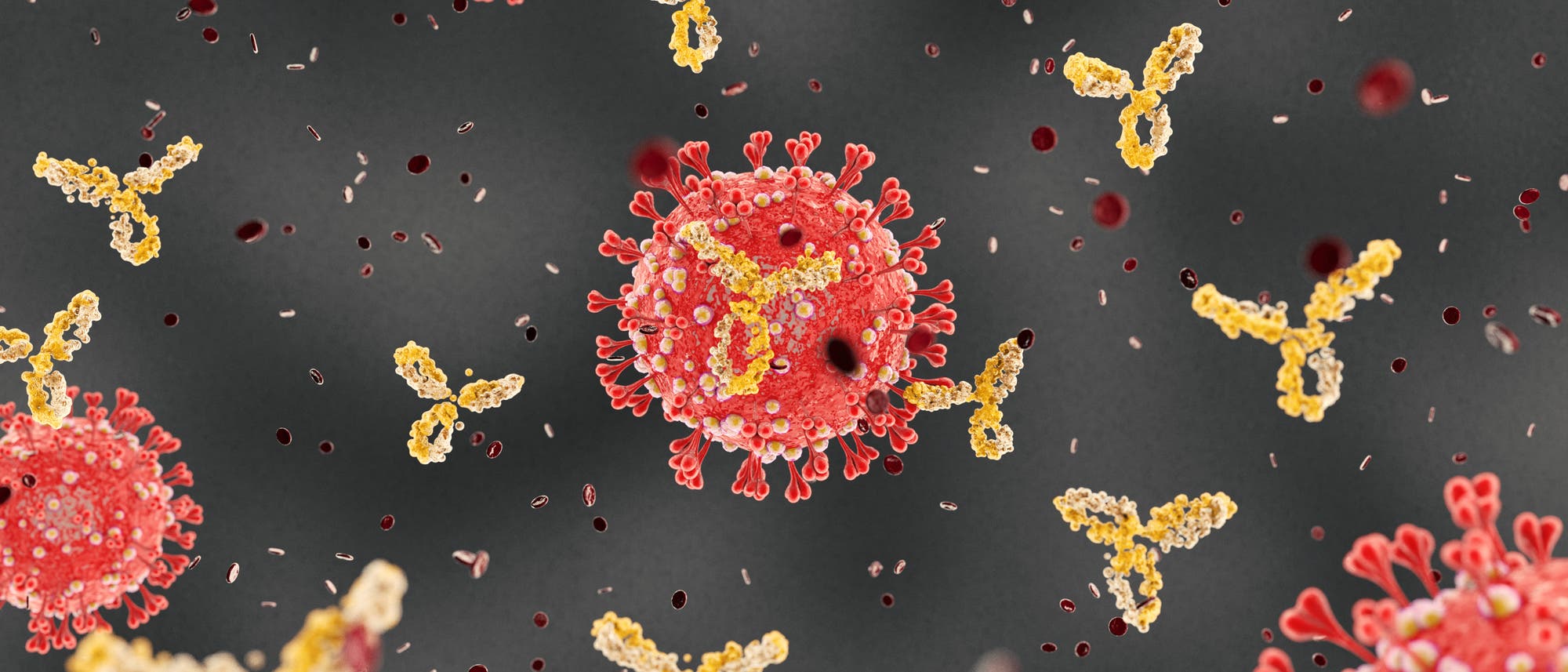 Schon früh in der Pandemie vermuteten Forscher, dass manche Menschen auf die Sars-Cov-2-Infektion mit einer überzogenen Immunantwort reagieren.