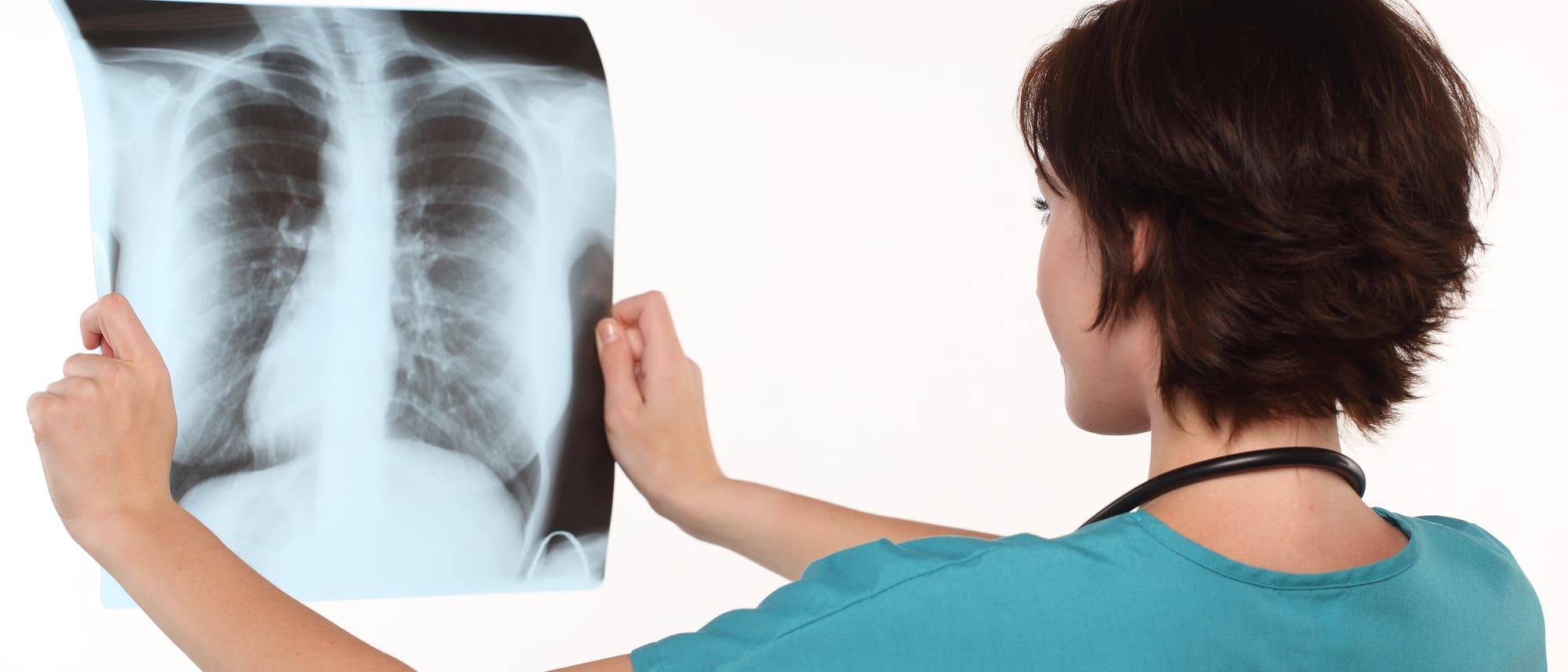 Eine Ärztin betrachtet eine Thorax-Röntgenaufnahme.
