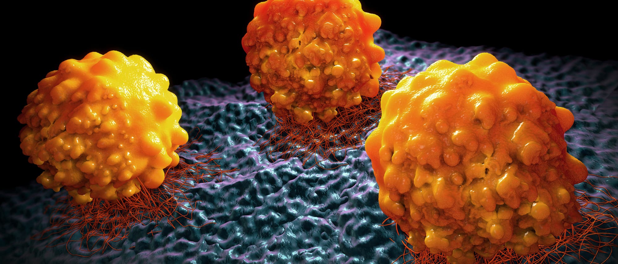 3-D-Illustration von Krebszellen