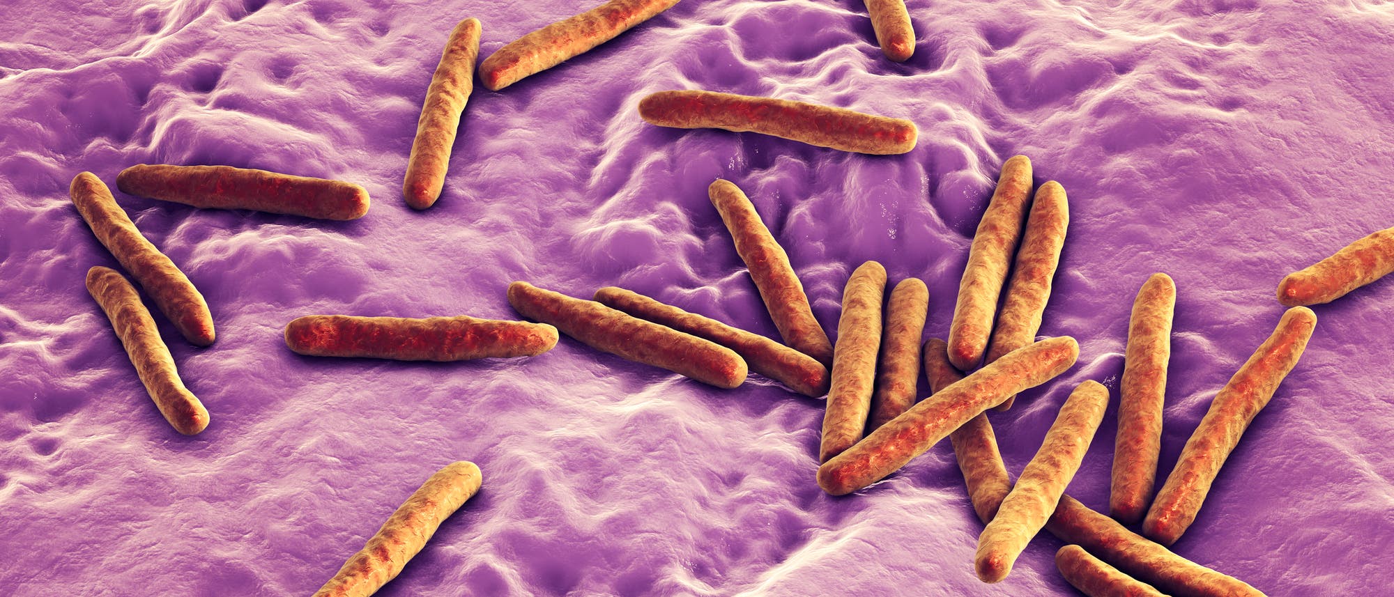 Stäbchenförmige Bakterien sorgen für Tuberkulose.