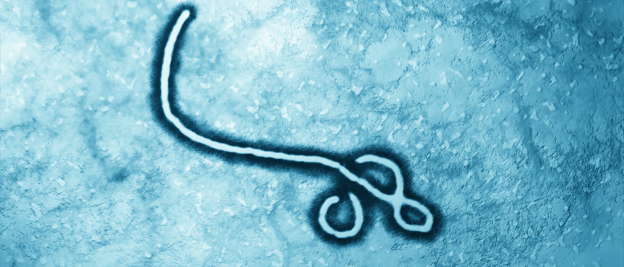 Ebola