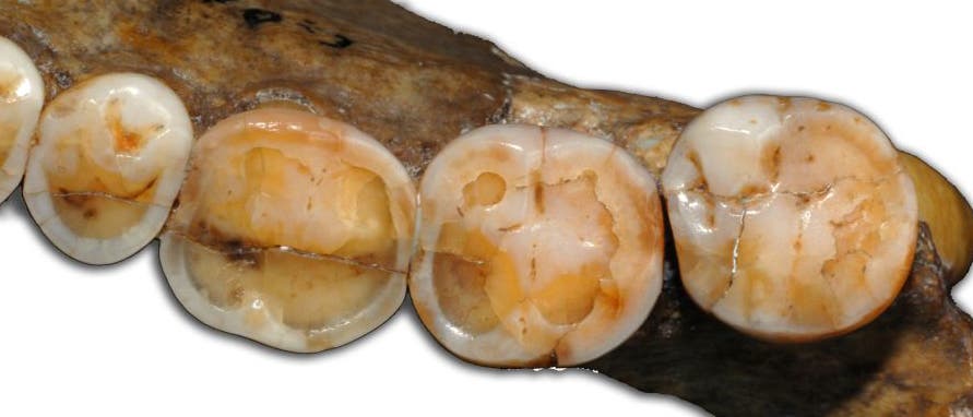 Zähne eines Neandertalers
