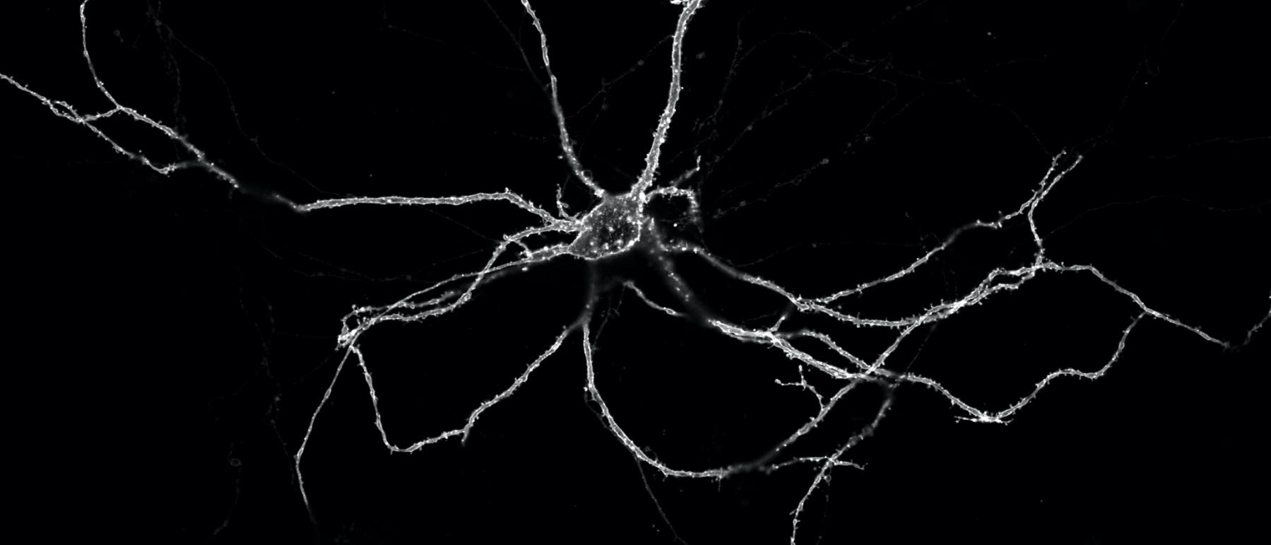 Eine Nervenzelle, an deren Membran fluoreszierende Proteine sitzen