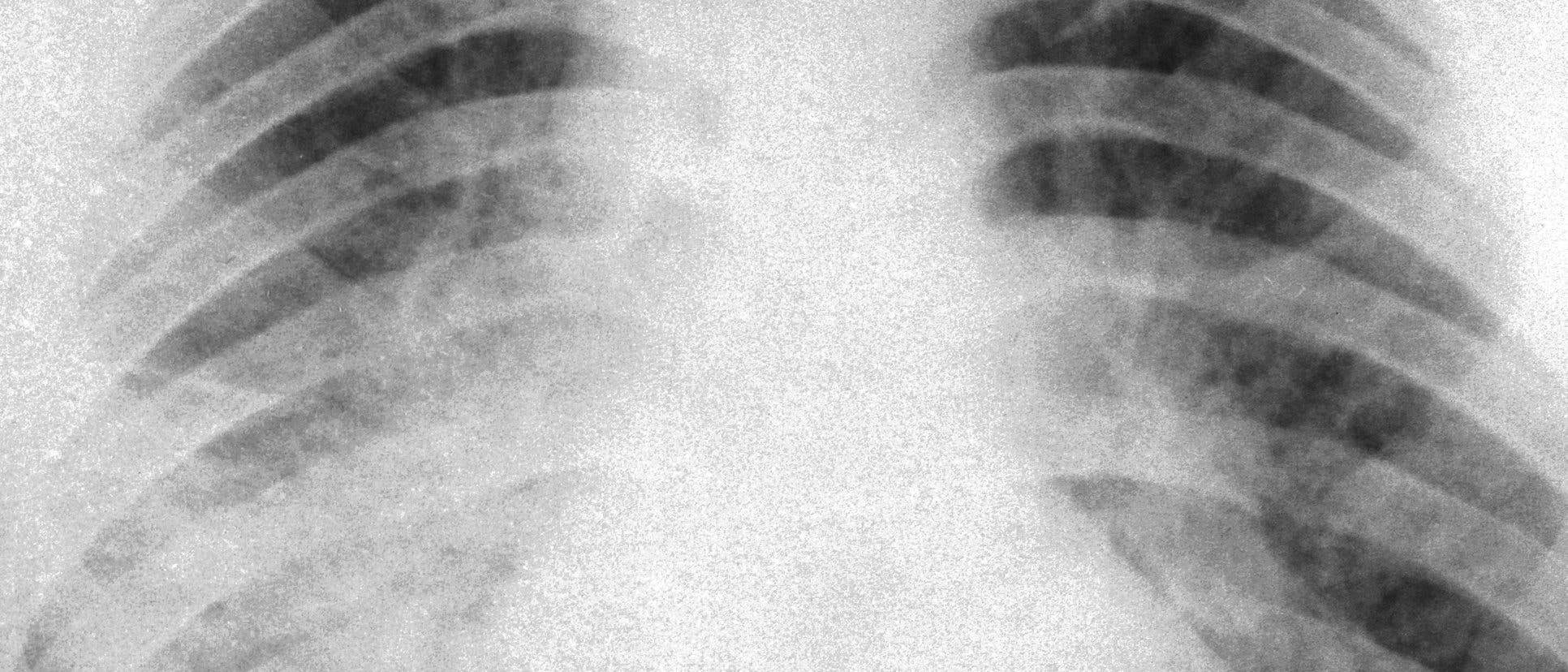 Röntgenbild von 1961