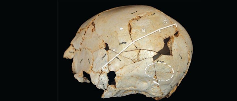 Cranium 14