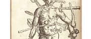 "Der verwundete Mann": Holzschnitt aus dem "Feldtbuch der Wundartzney" von 1517