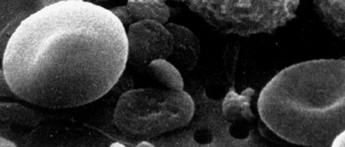 Thrombozyten zwischen anderen Blutzellen
