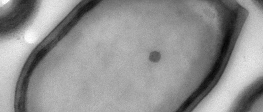 Neuer Größenrekord: Das Pandoravirus