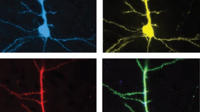 Fluoreszierende Neuronen
