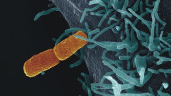 Kontakt: Bakterium an Zelle