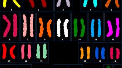 Chromosomen von Craig Venter in bunt