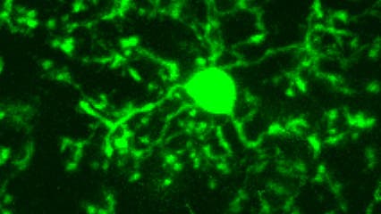 Mikrogliazelle im gesunden Gehirn