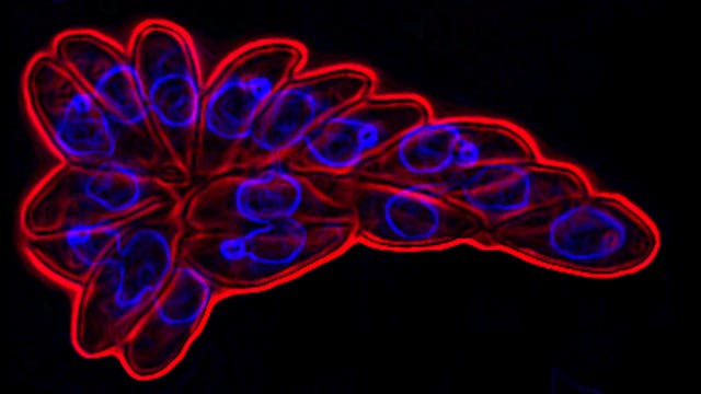 <i>Toxoplasma gondii</i> in Wirtszelle