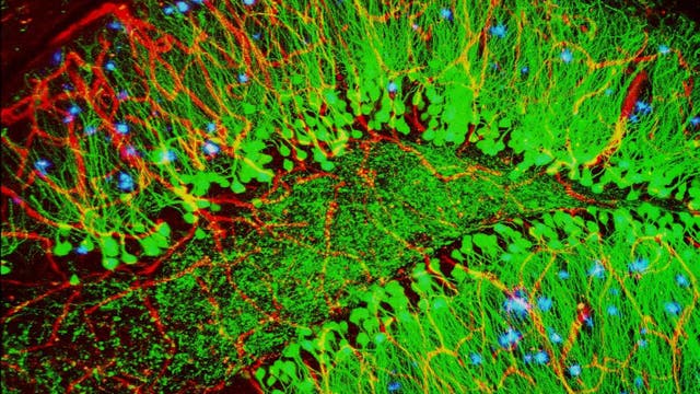 Diese Aufnahme zeigt erste Alzheimer-Plaques (blau) im Hirn einer Maus. Blutgefäße sind in rot, Nervenzellen in grün dargestellt.