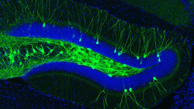 Mäuse-Hippocampus mit grün aufleuchtenden Zellen, die für die Gedächtnisspur verantwortlich sind