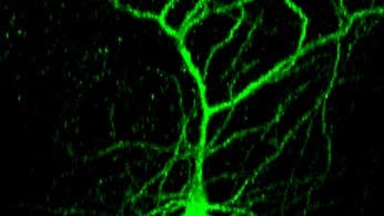 Leuchtendes Neuron