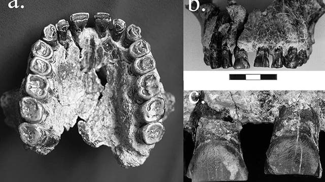 Das Fossil mit der Kennzeichnung "OH 65" aus Tansania wird einem Homo habilis zugeordnet und ist nahezu vollständig erhalten. Die Kratzer auf den Schneidezähnen sind auch nach 1,8&nbsp;Millionen&nbsp;Jahren mit bloßem Auge erkennbar und verraten etwas über die Rechtshändigkeit des Individuums.