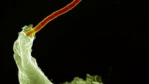 Neutrophiler Granulozyt nimmt eine Kette von Anthraxbakerien auf