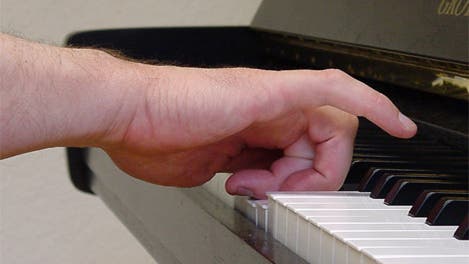 Dystonische Hand beim Klavierspiel