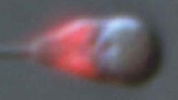 Spermienkopf mit rot gefärbten Mitochondrien