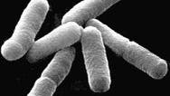 <i>Escherichia coli</i>