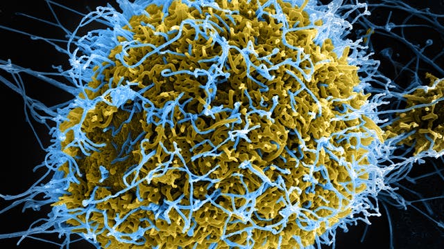 Ebolainfizierte Zelle