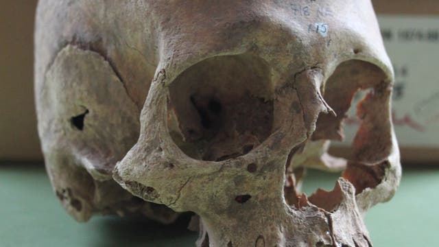 Schädel einer toten Wikingerfrau