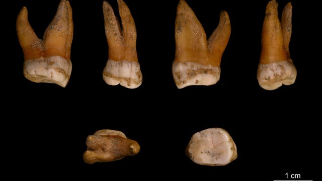 Neandertaler-Zähne