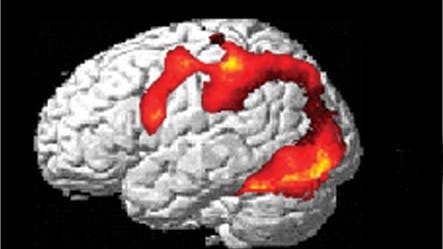 Gehirn im fMRI