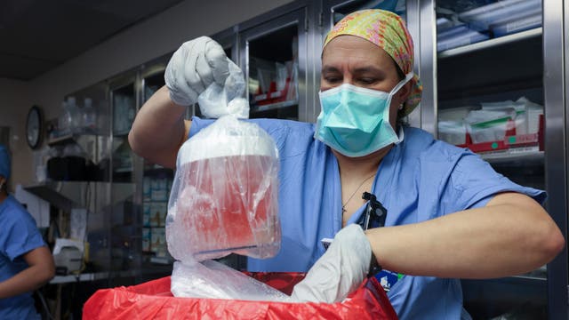 Eine medizinische Fachkraft nimmt eine Schweineniere in einem runden Behälter aus einer Transportbox