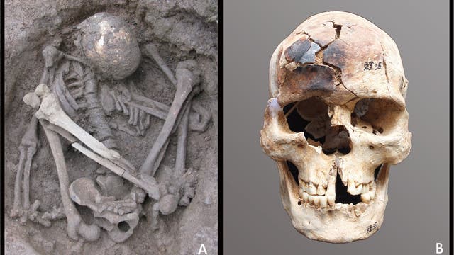 Das Bild zeigt zwei wissenschaftliche Abbildungen von menschlichen Skelettteilen. Links (A) ist ein vollständiges Skelett in einer gebückten Position im Erdreich zu sehen, möglicherweise eine archäologische Ausgrabung. Rechts (B) ist ein Schädel mit sichtbaren Rissen und Verfärbungen abgebildet. Beide Abbildungen bieten Einblicke in die menschliche Anatomie und archäologische Funde.