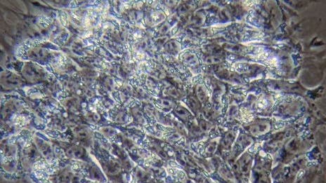 Embryonale Stammzellen