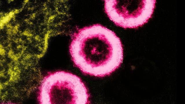 Elektronenmikroskopisches Bild von drei HIV-Partikeln (rosa), die aus der Membran einer Wirtszelle (gelblich-grün) austreten.